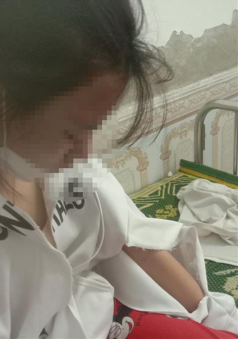 Nữ sinh bị hành hung đến “chấn động não”, khởi tố chủ cửa hàng tạp hóa